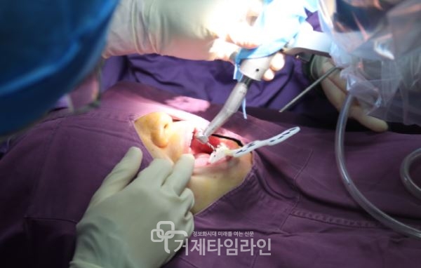 [사건사고]임플란트 보험사기 치과의사·보험청구 환자 검거 